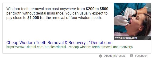 1Dental Featured Snippet Example No Dental Insurance